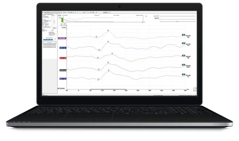 皮質聴覚誘発電位検査画面