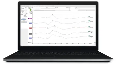 皮質聴覚誘発電位検査画面