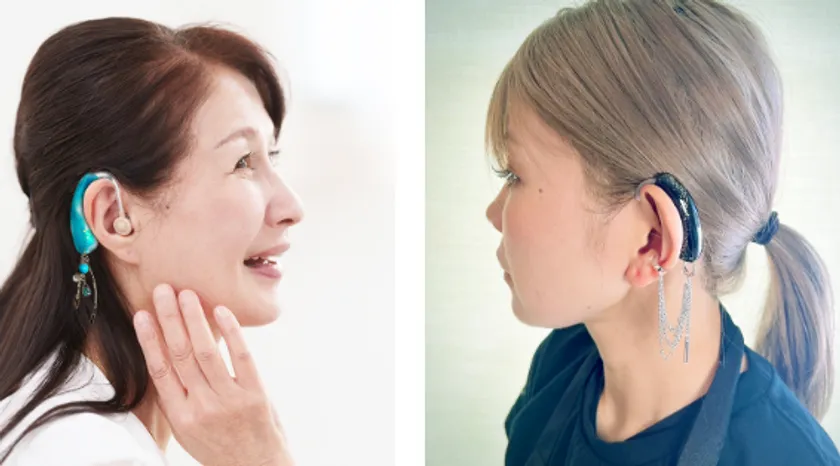 装着した様子