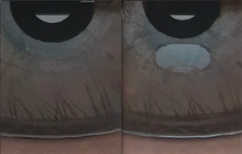 涙の測定時の画像