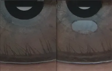 涙の測定時の画像