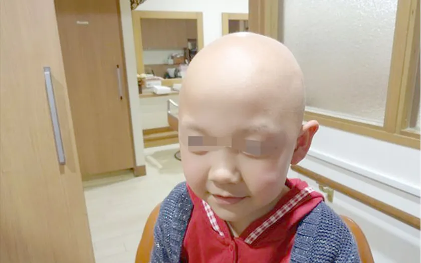 ウィッグ着用前の様子