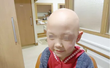 ウィッグ着用前の様子