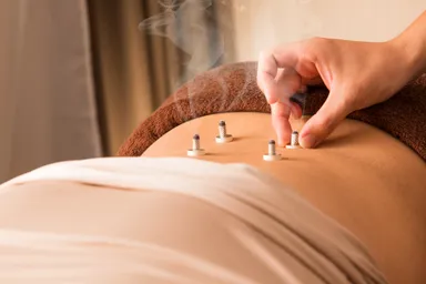 日本鍼灸オプションのイメージ