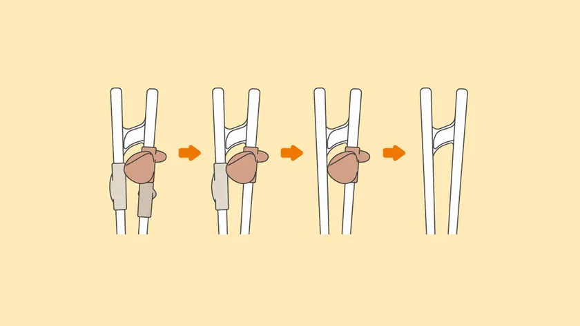 パーツを外してステップアップ