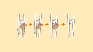 パーツを外してステップアップ