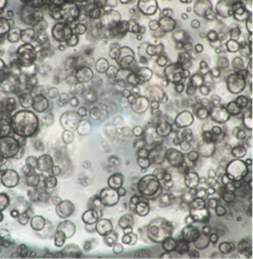 ヒト膵がん患者由来オルガノイドの増殖試験(8日後) a) InnoCell(R) プレート Nタイプ/地方独立行政法人大阪府立病院機構大阪国際がんセンター 平塚 徹 チームリーダー ご提供