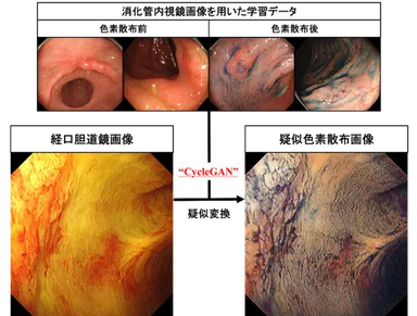 図1：白色光画像(左)から疑似色素散布画像(右)へのAIによる変換技術