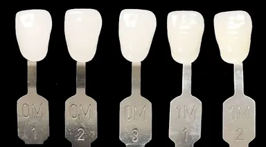 ハリウッドスマイルの白さ「ルミネアーズ」