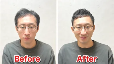 M字薄毛をカットで改善(5)