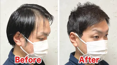 M字薄毛をカットで改善(2)