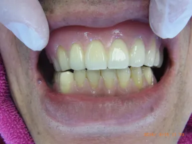 男性装着後　上下