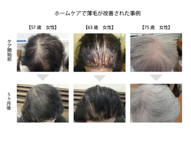 ホームケアでの改善点