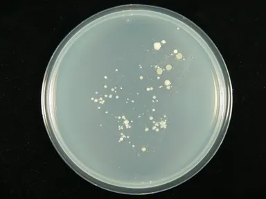 サンドイッチに付着した雑菌