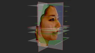 3D撮影画像(横顔)