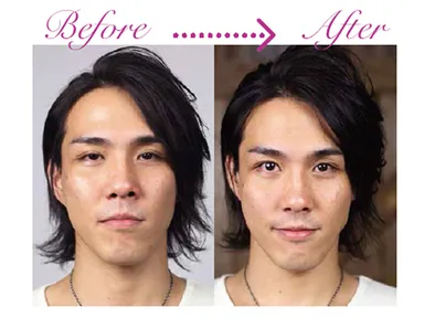 フェイススキンシャルのお客様 男性 29歳