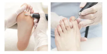 爪・足裏のクリーニング