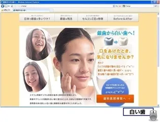 Z冠サイト