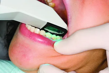 口腔内使用でも疲れにくい