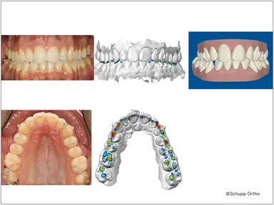 より精密な診断が可能
