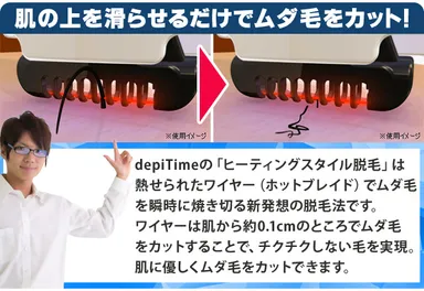 ヒーティングスタイル脱毛