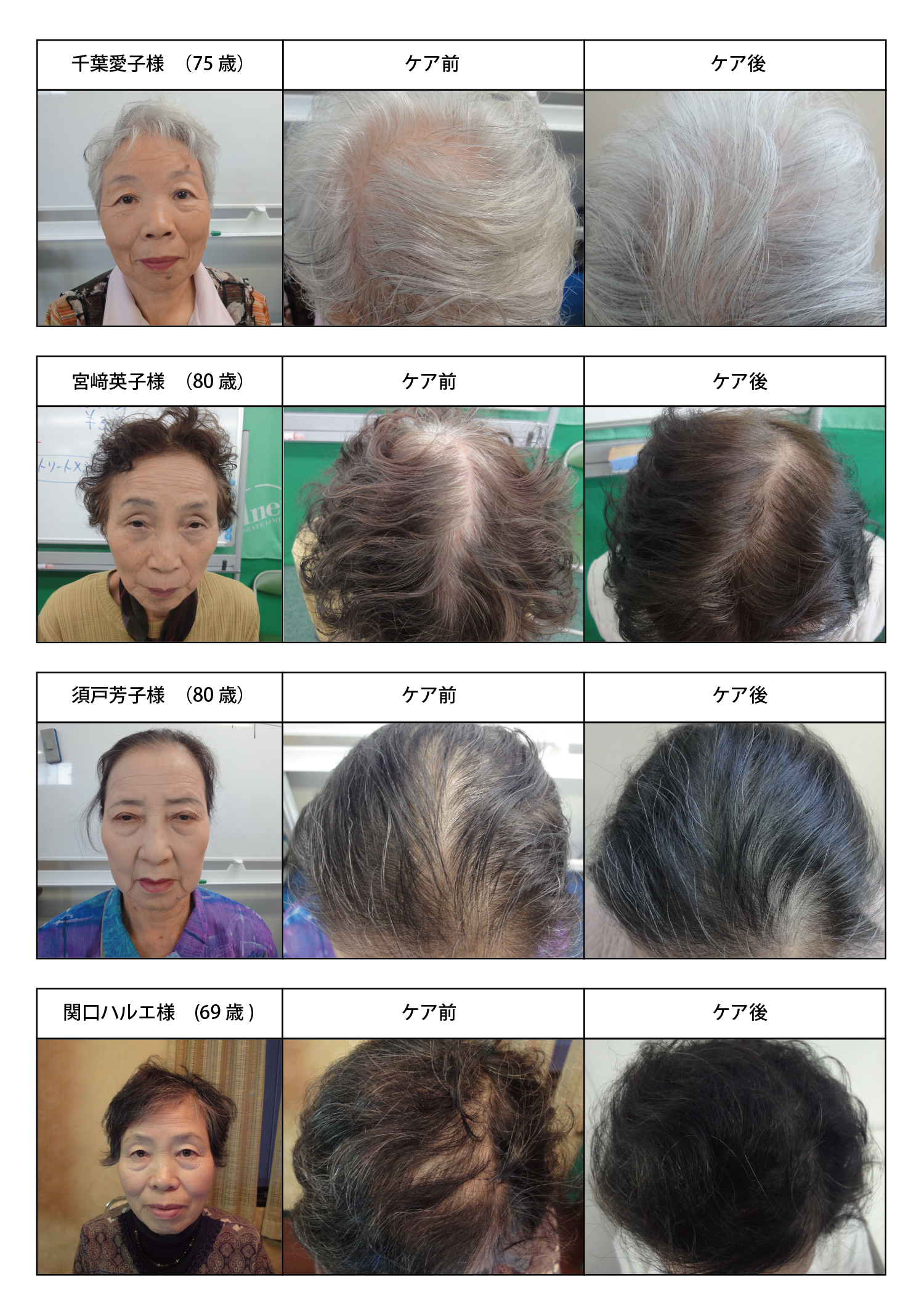 加齢による女性の薄毛はホームケアで が改善 半年間の頭皮ケア効果に関する調査結果 株式会社エル ド ボーテのプレスリリース