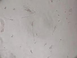 写真2：添加物入り育毛剤24時間後(細胞全滅)