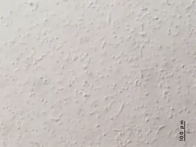 一般家庭の追いだき配管から採取した残湯を光学顕微鏡でみた様子4