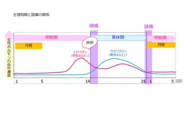 生理周期と頭痛の関係