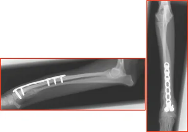 術後8週間後　画像