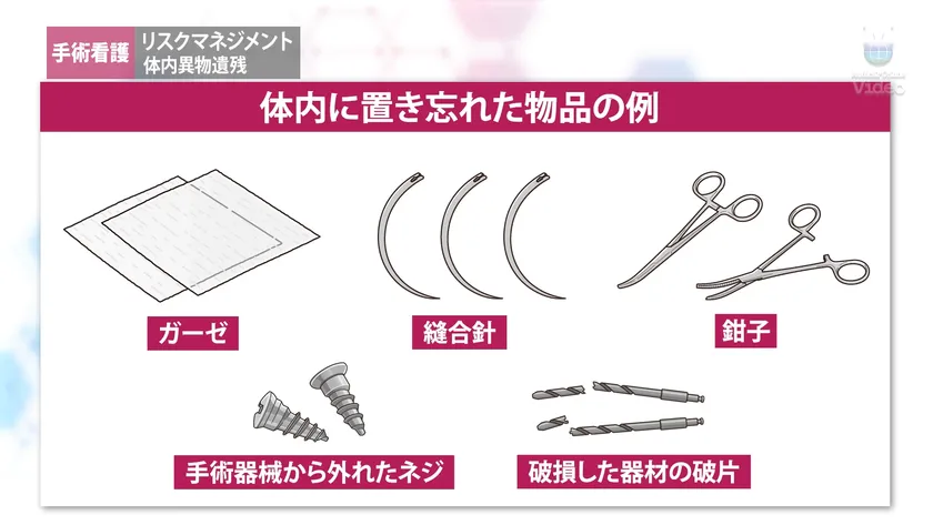 体内遺物残留