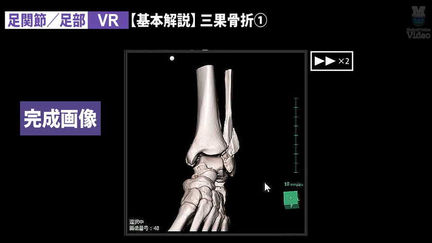 足関節