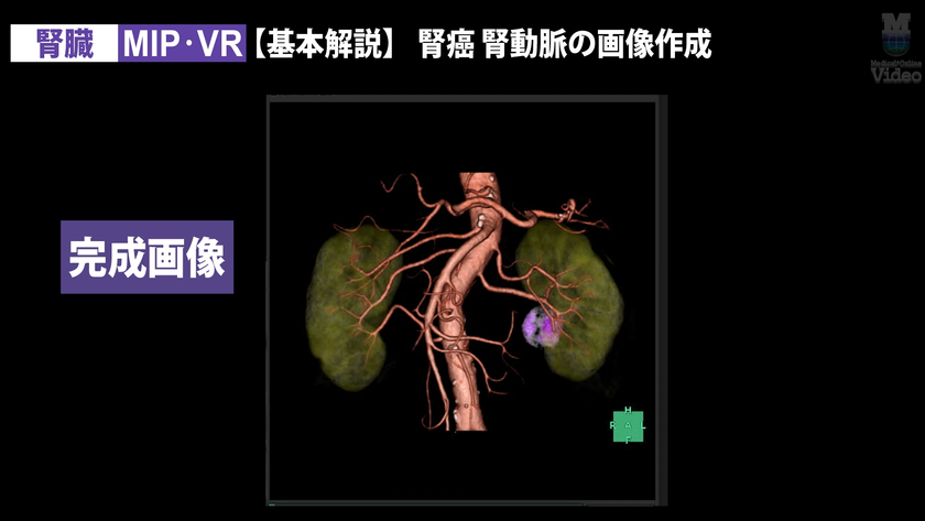 腎臓