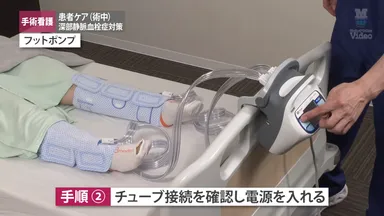 深部静脈血栓症対策