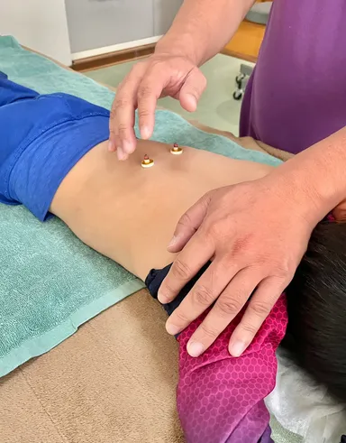 お灸セルフケアの様子
