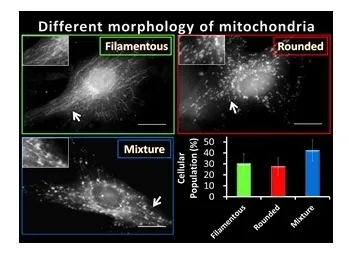 毛乳頭細胞内に存在する