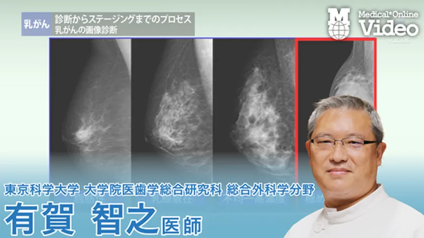 乳がん 診断からステージング