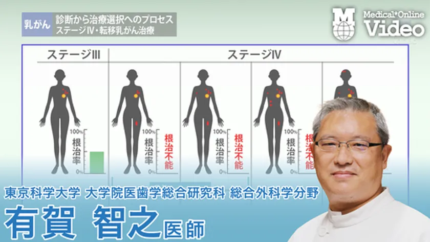 乳がん 診断から治療選択