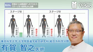 乳がん 診断から治療選択