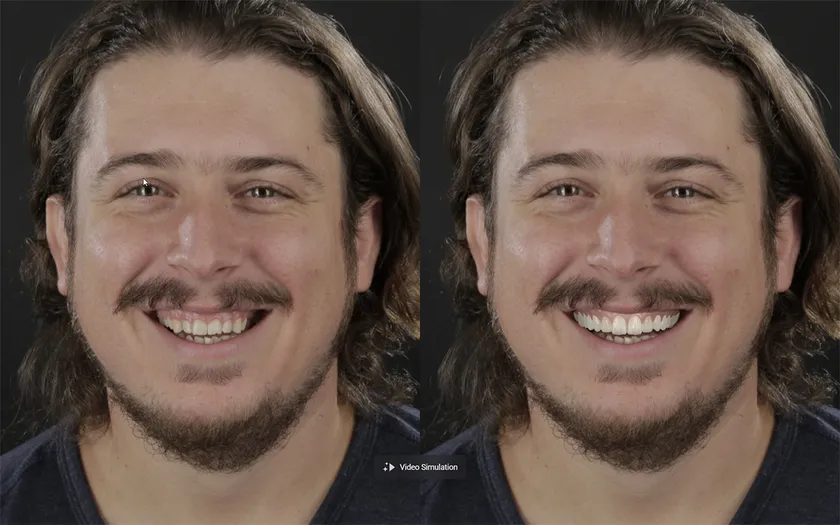 ビフォー＆アフター