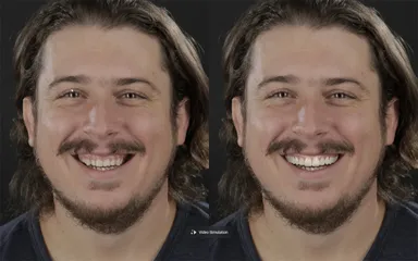 ビフォー＆アフター