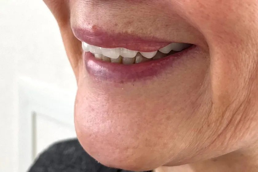 白一色の装着時