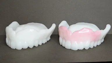 日本初、入れ歯型マウスピース