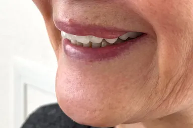 白一色の装着時