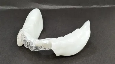 部分入れ歯も製作可能