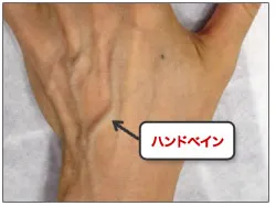 ハンドべイン　2