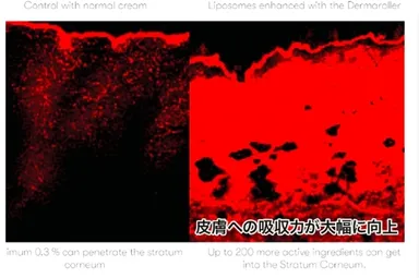 ダーマローラー皮膚浸透・経皮吸収