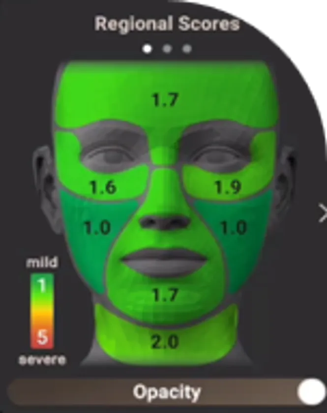 部分的肌スコア