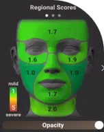 部分的肌スコア