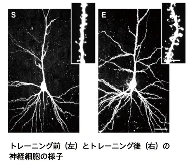 トレーニング前後の脳細胞の様子